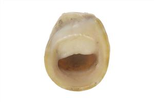 Bead (pierced shell)
Photographer:ostrovski ivgen