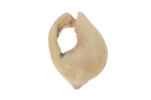 Bead (pierced shell)
Photographer:ostrovski ivgen